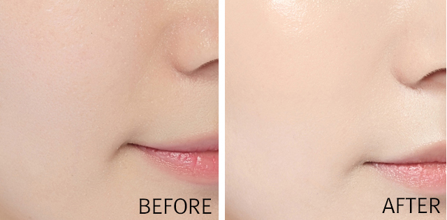 before & After
